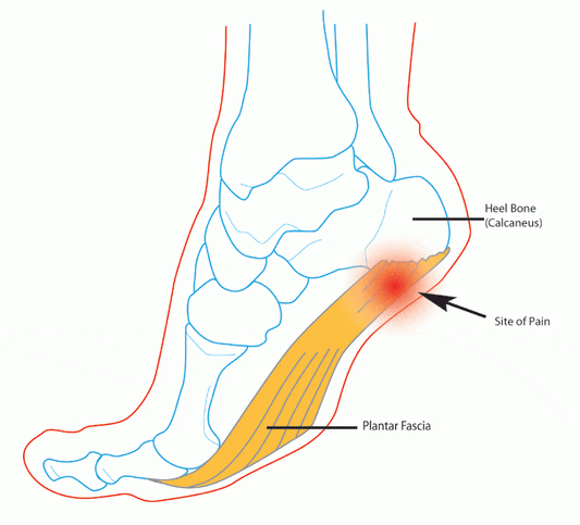 How to prevent foot pain at work