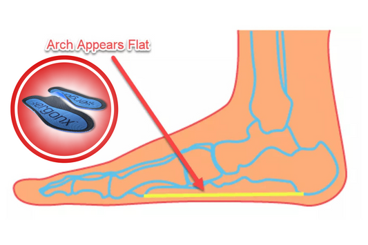 Flat Feet at Work? Here's What You Should Be Wearing