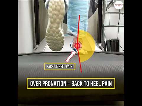 Fix Heel Pain Now Understanding Foot Mechanics Overpronation Tips Explained #HeelPain #FootHealth