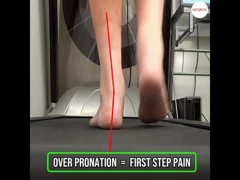 Overpronation and Heel Pain: How Insoles Can Help