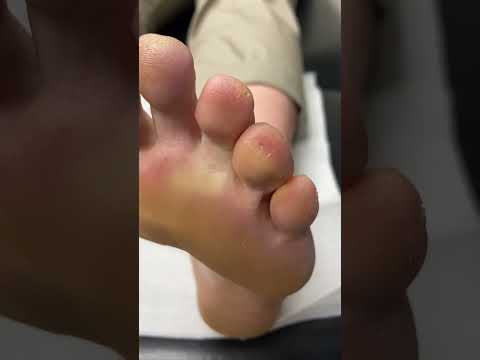 Seed Corn Toe Balance Challenge Tutorial Beginner Tips and Tricks #SeedCornBalance #ToeBalance