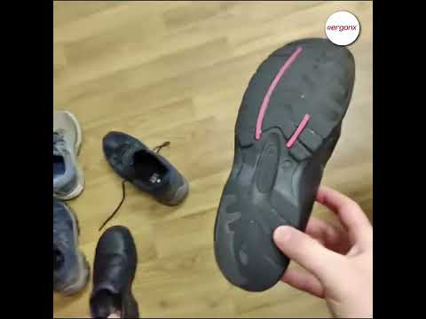 What Shoe Wear Patterns Reveal About Foot Function