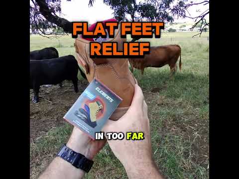 Flat feet aren’t just a foot shape — they change how your body works