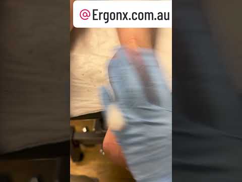 Ultimate Cracked Heels & Callus Removal by Podiatrist #Satisfying #Skincare