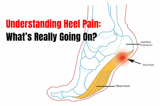 Why Do My Heels Hurt After a Long Day at Work?